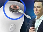 FDA cho phép Neuralink thử nghiệm cấy chip lên não người